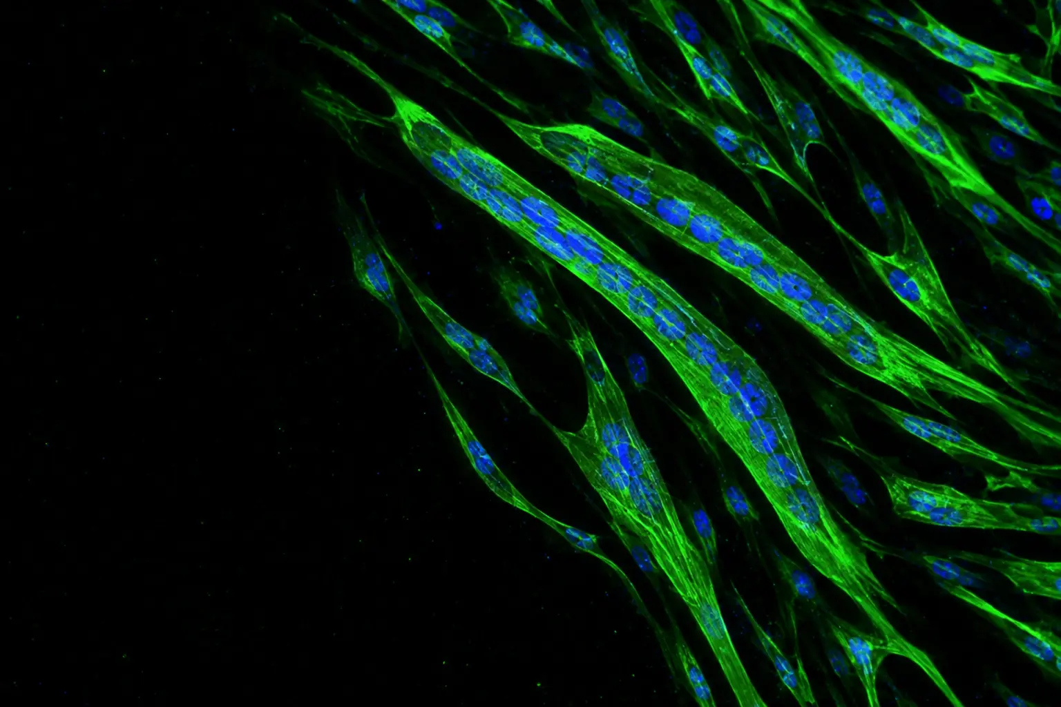 Fluorescence micrograph: cultured human muscle cells fusing into long green myotubes with chains of blue nuclei