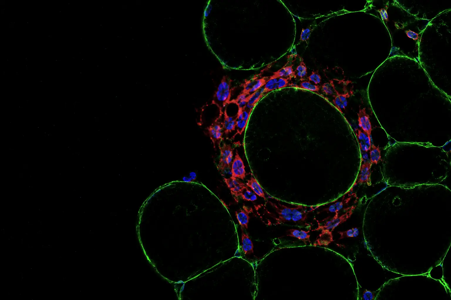 Fluorescence micrograph: inflamed fat tissue, round fat cells outlined in green with red macrophages crowding around one of them