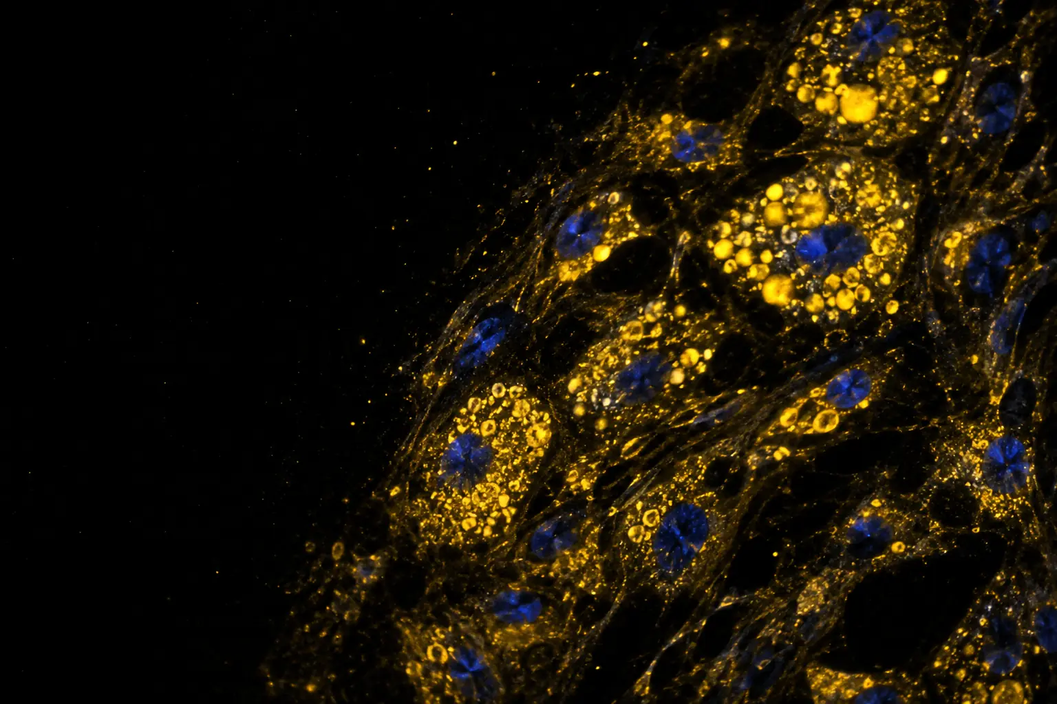 Fluorescence micrograph: foam cells from an artery wall