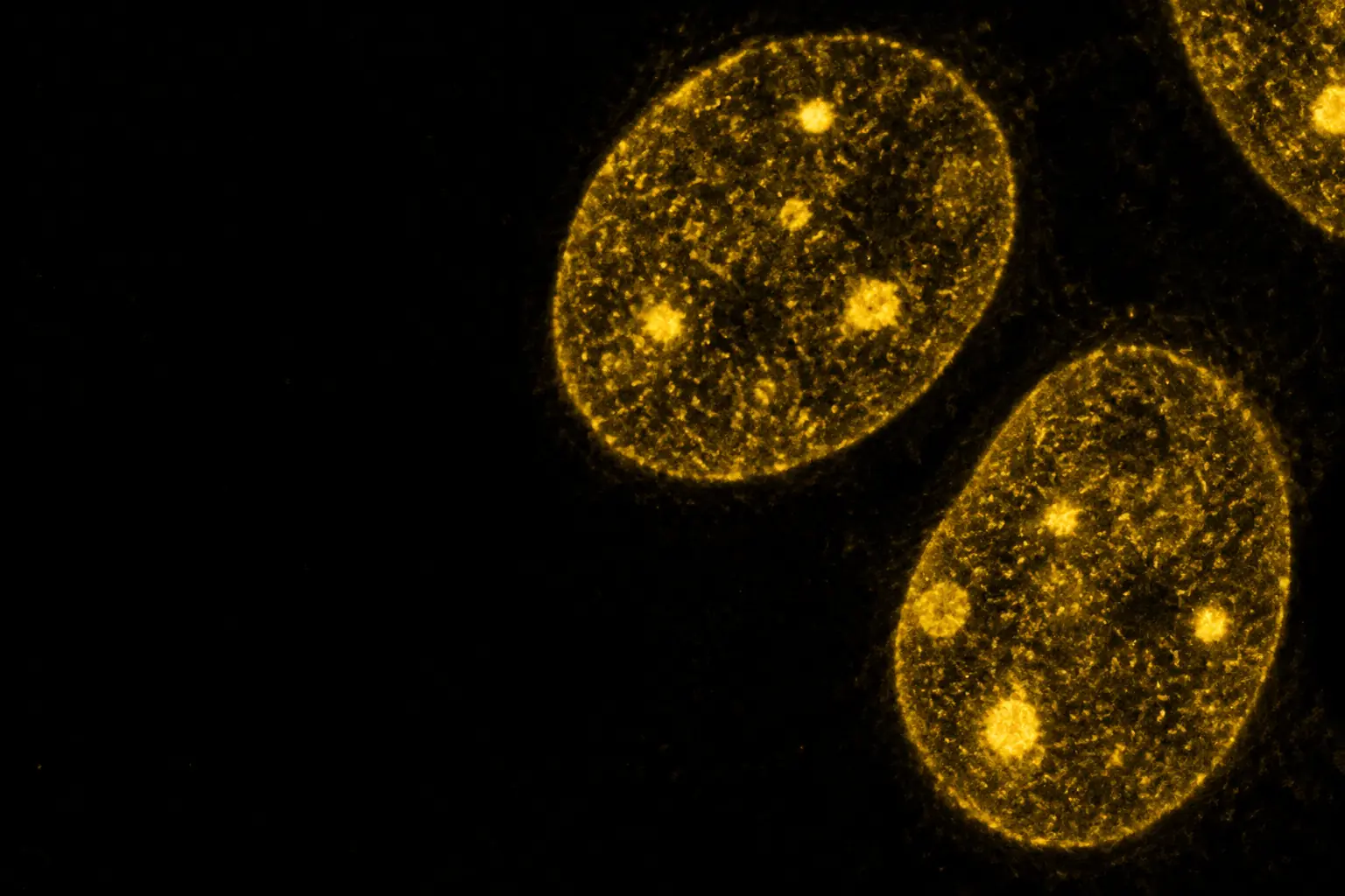 Fluorescence micrograph: two cell nuclei at high magnification, chromatin in golden amber with bright dense foci