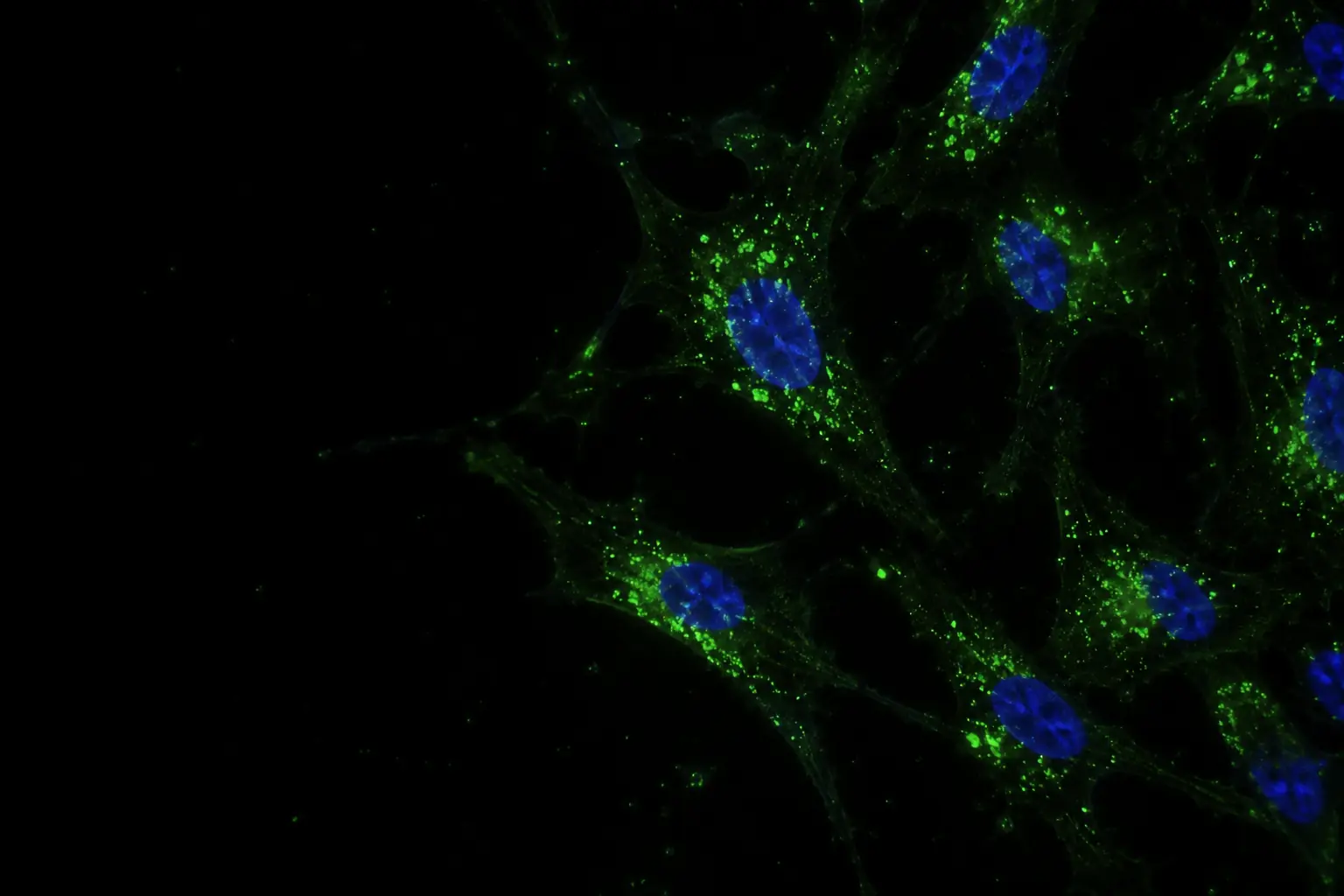 Fluorescence micrograph: skin fibroblasts taking up labelled exosomes, green points around blue nuclei