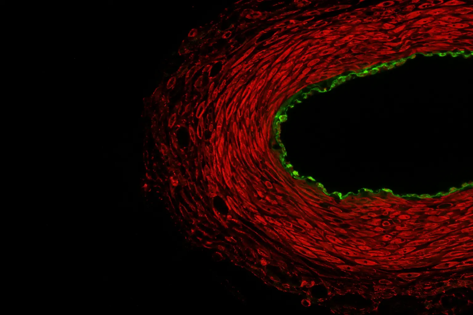 Fluorescence micrograph: cross-section of a coronary artery wall