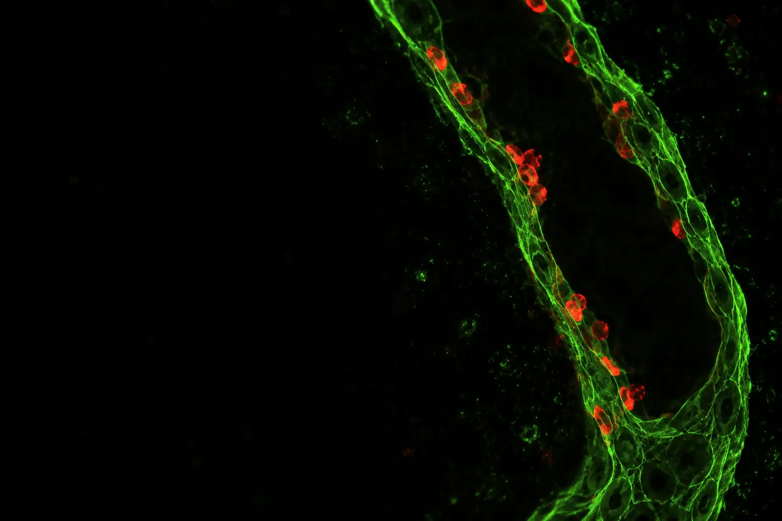 Fluorescence micrograph: the lining of a small blood vessel stained green with immune cells in red adhering to its wall
