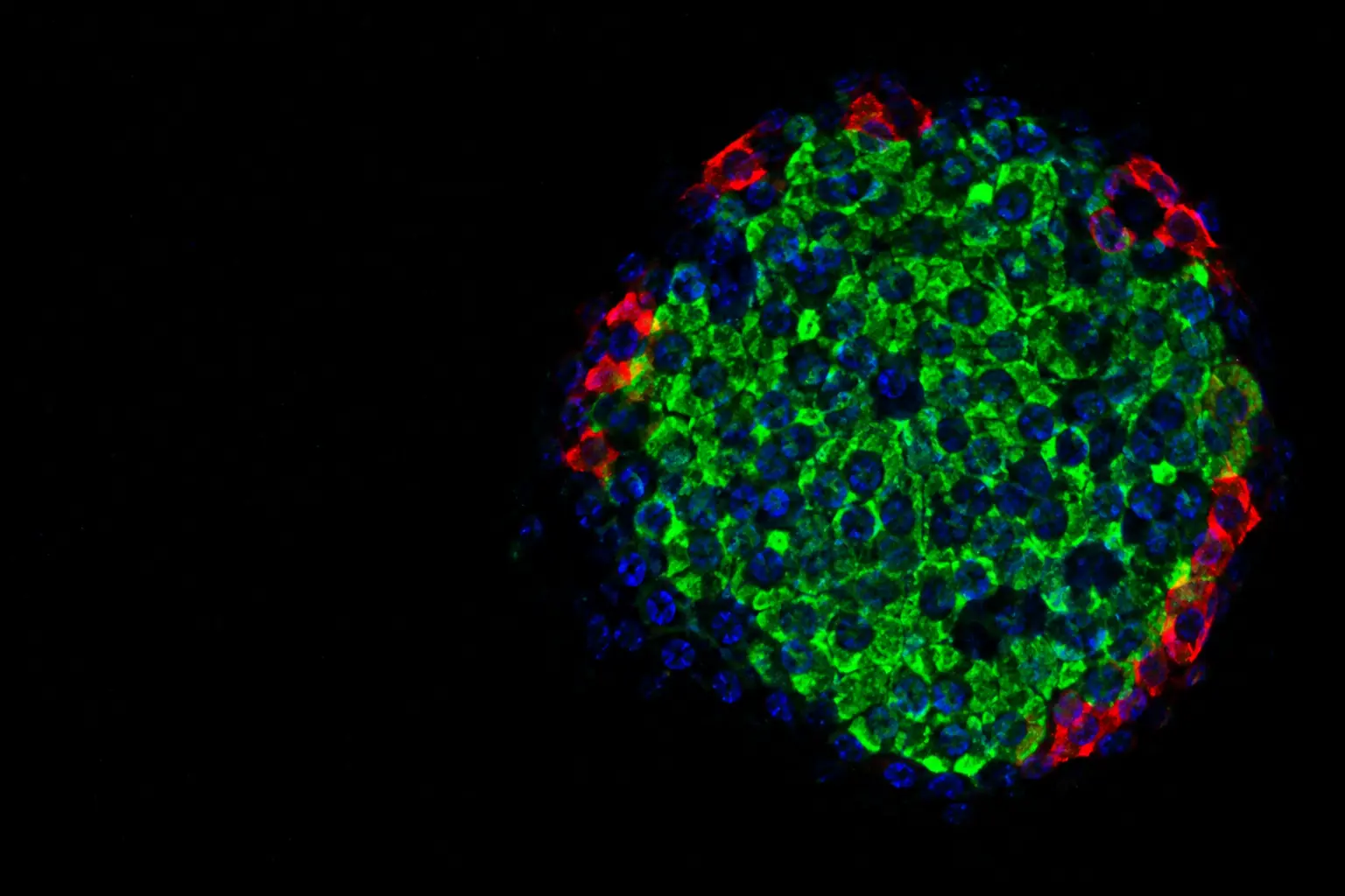 Fluorescence micrograph: pancreatic islet with insulin-producing beta cells in green