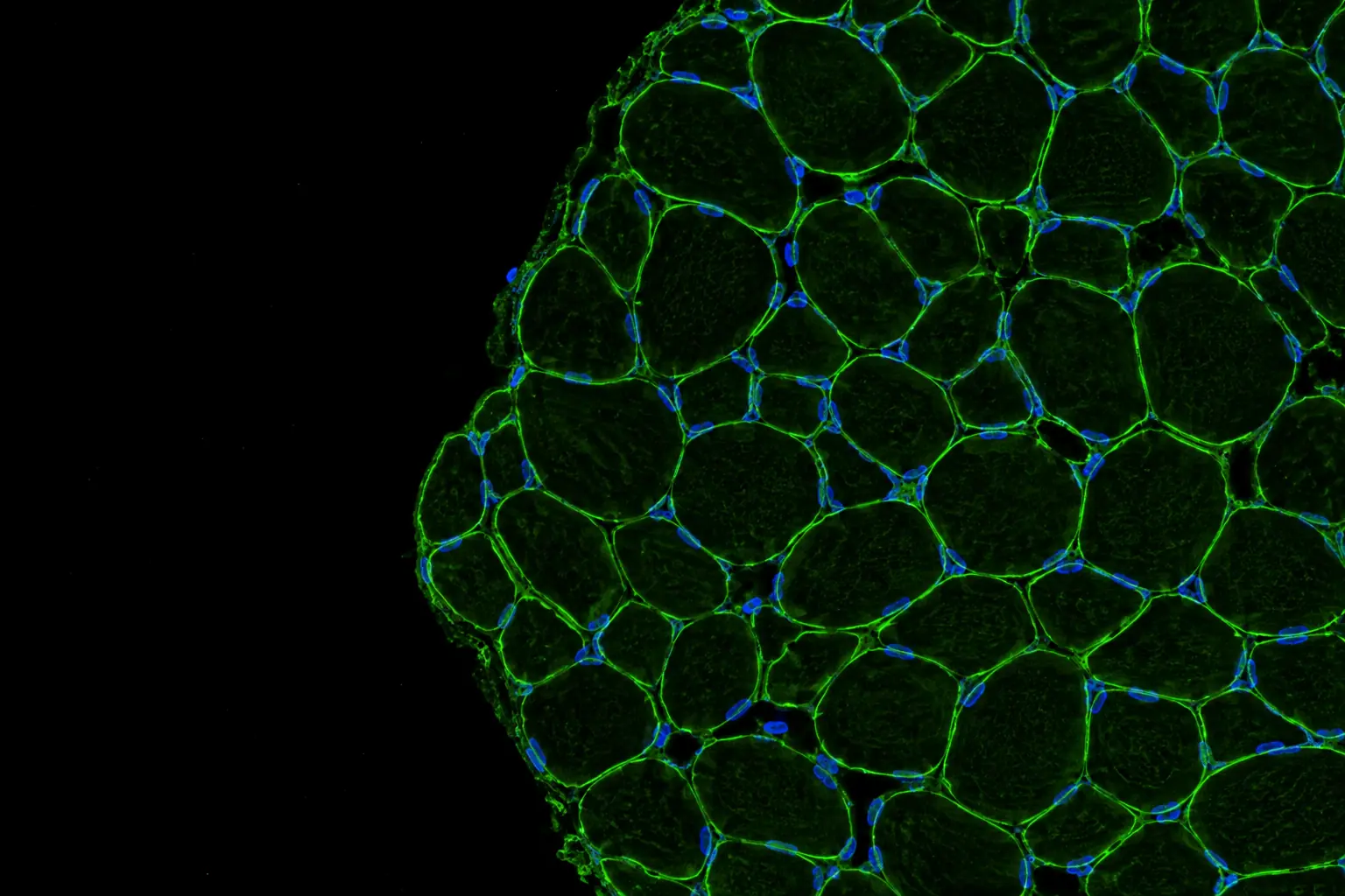 Fluorescence micrograph: cross-section of skeletal muscle
