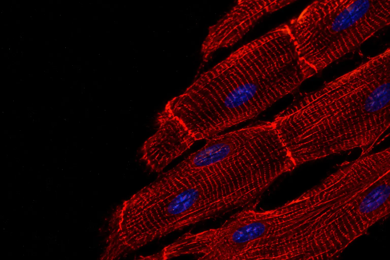Fluorescence micrograph: heart muscle cells with cross-striations stained warm red