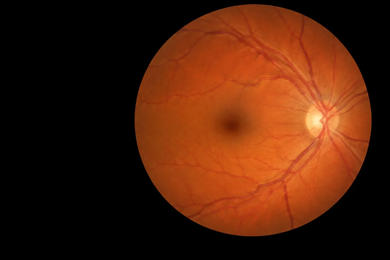 Fundus photograph of a healthy human retina: the circular orange-red field of the retina on pure black