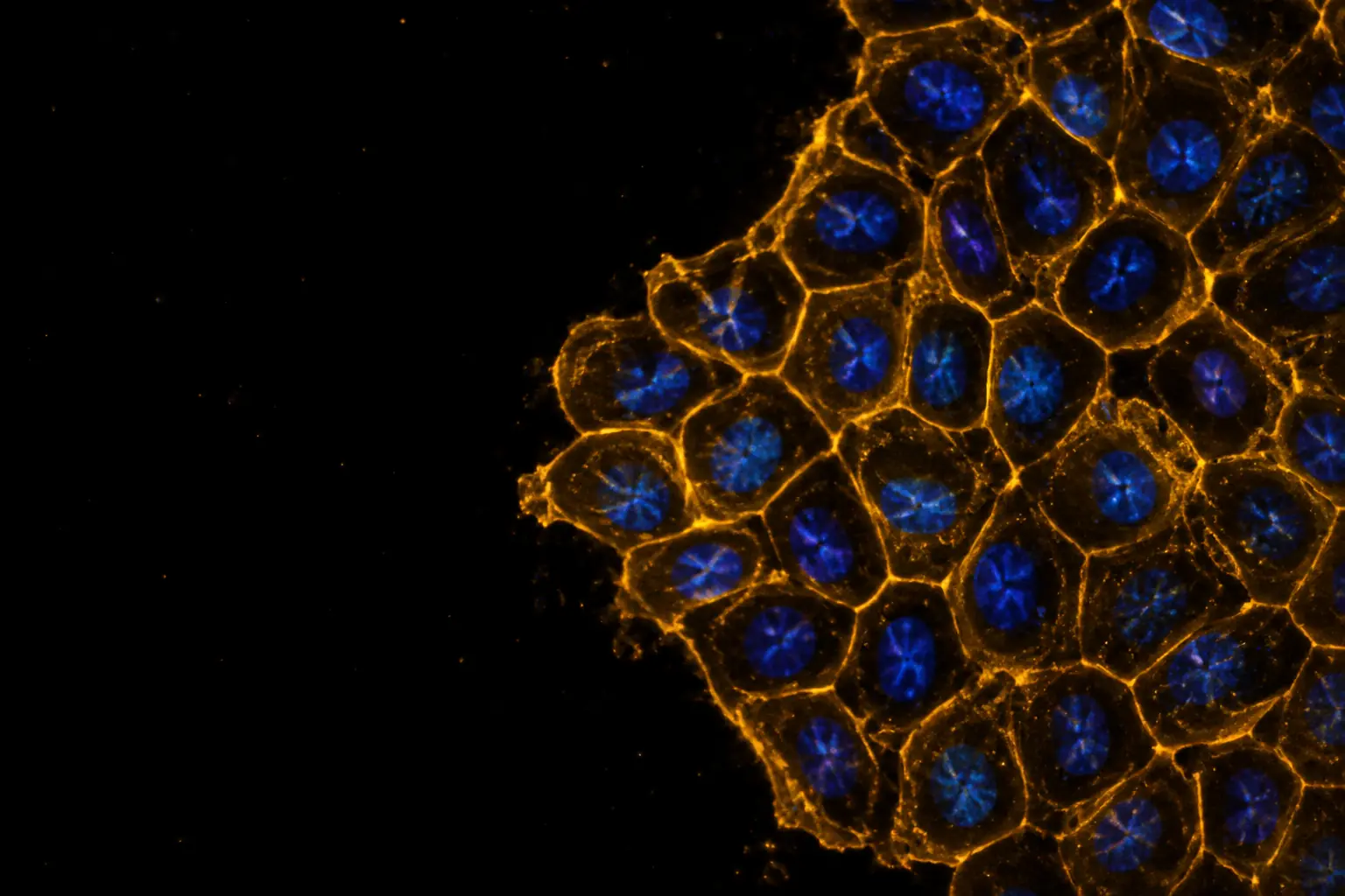 Fluorescence micrograph: a sheet of human cells with their lipid membranes stained golden amber around blue nuclei