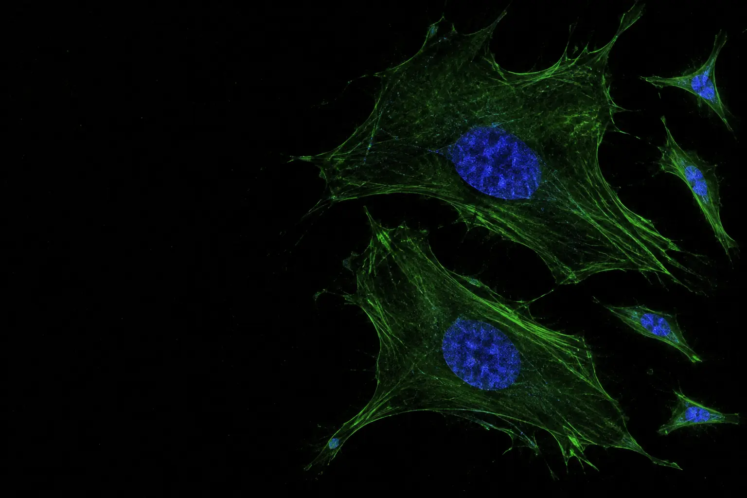 Fluorescence micrograph: large flattened senescent fibroblasts with enlarged nuclei in blue and a sparse green actin skeleton