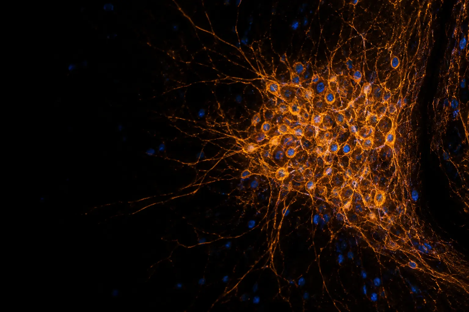 Fluorescence micrograph: neurons of the suprachiasmatic nucleus, the brain's circadian clock, stained warm orange