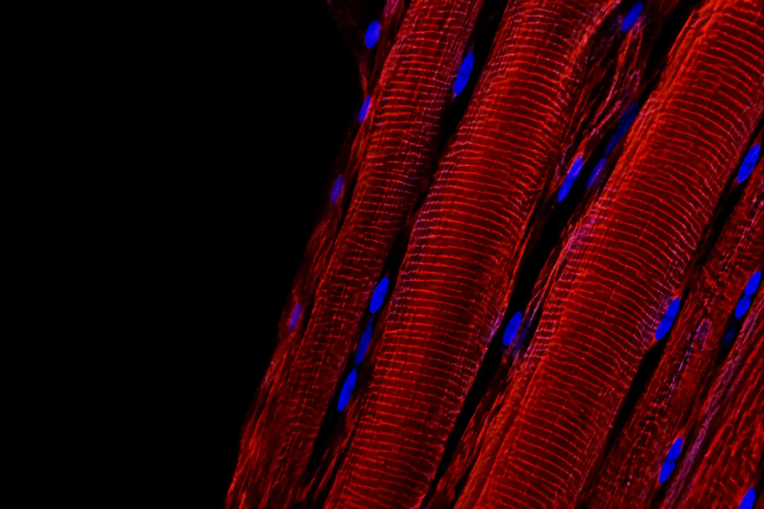 Fluorescence micrograph: longitudinal skeletal muscle fibres with fine cross-striations stained warm red