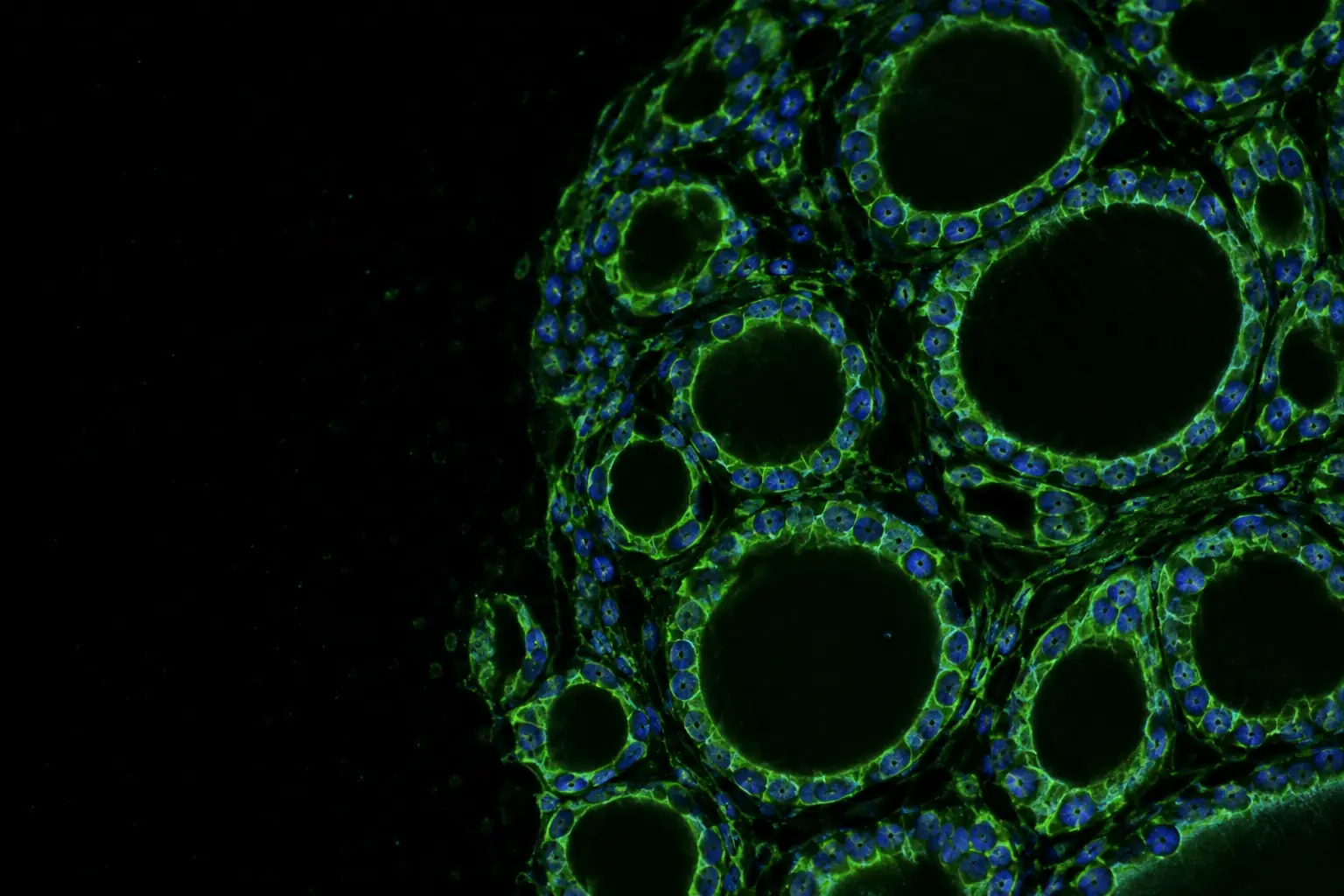 Fluorescence micrograph: thyroid follicles lined with cells stained green