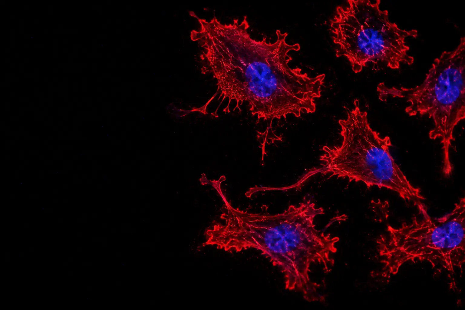 Fluorescence micrograph: macrophages, the immune cells of inflammation