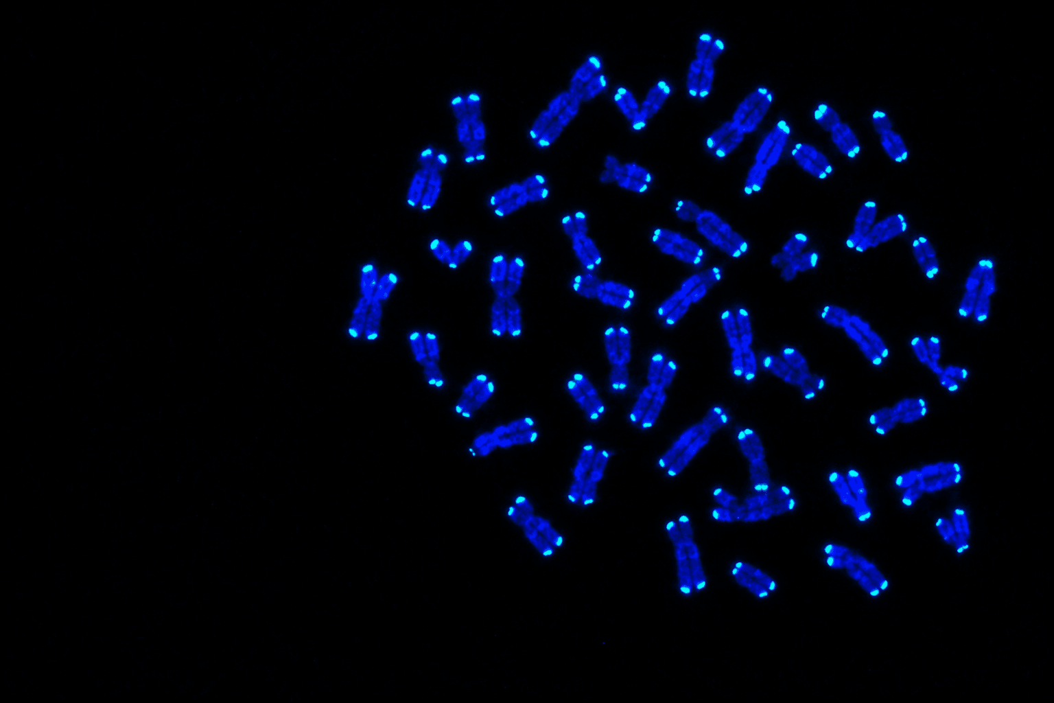 Fluorescence micrograph of chromosomes