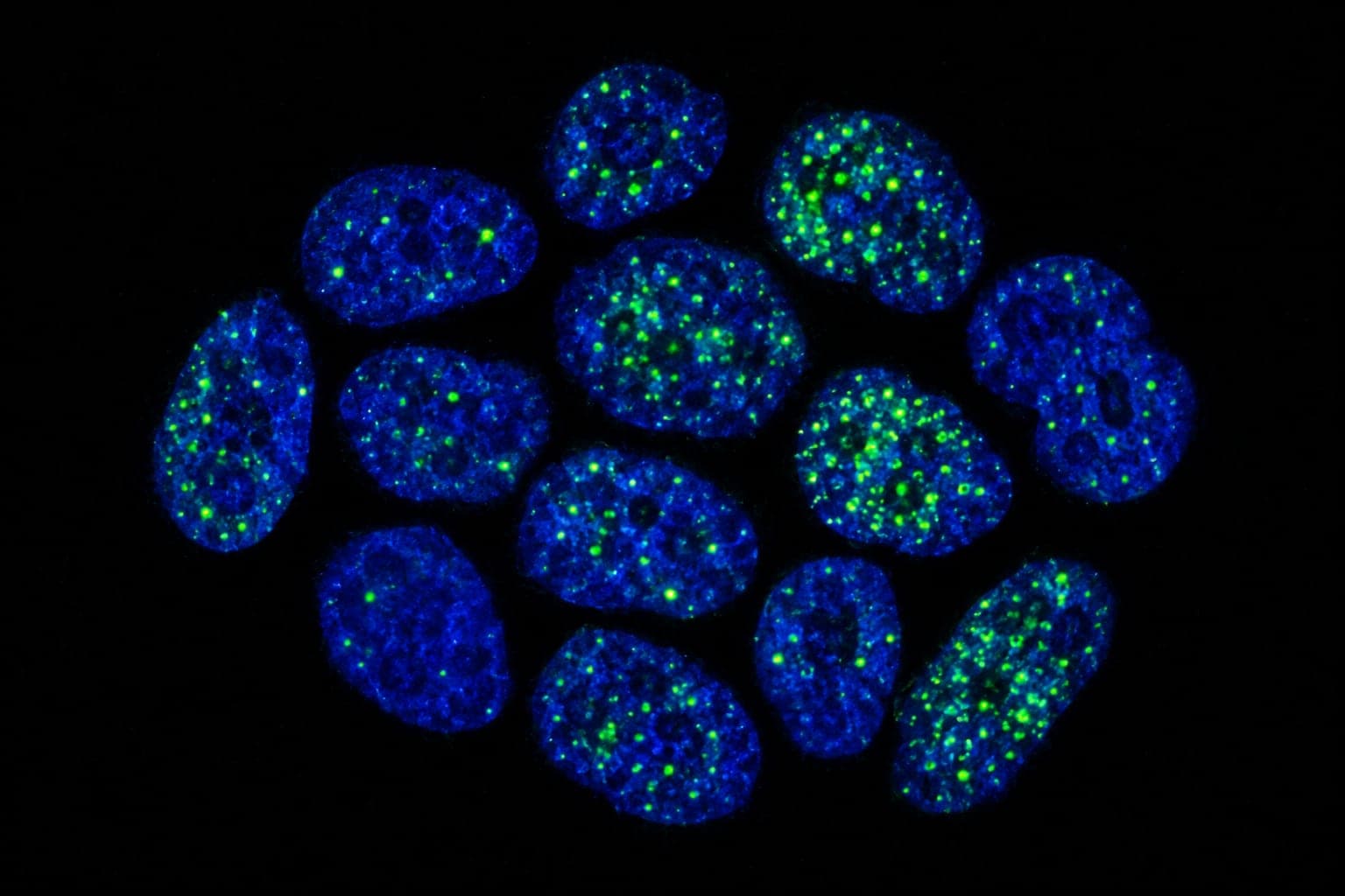Fluorescence micrograph of cell nuclei, DNA in blue with methylation marks in green: the chemical tags an epigenetic age test reads