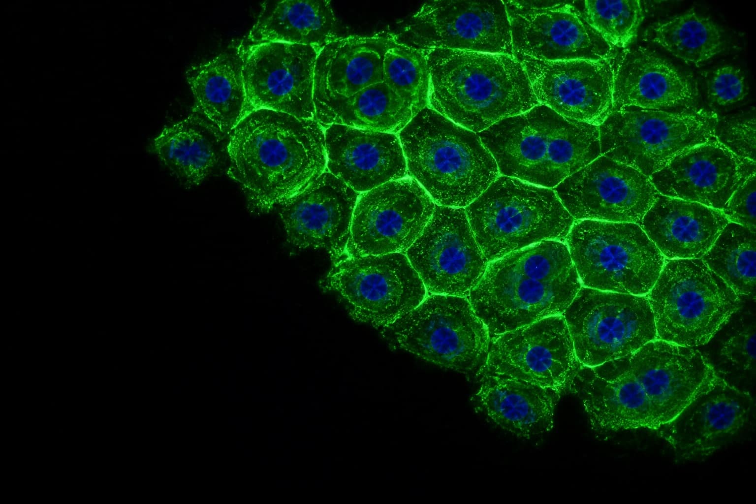 Fluorescence micrograph of liver cells stained with a glutathione-sensitive probe