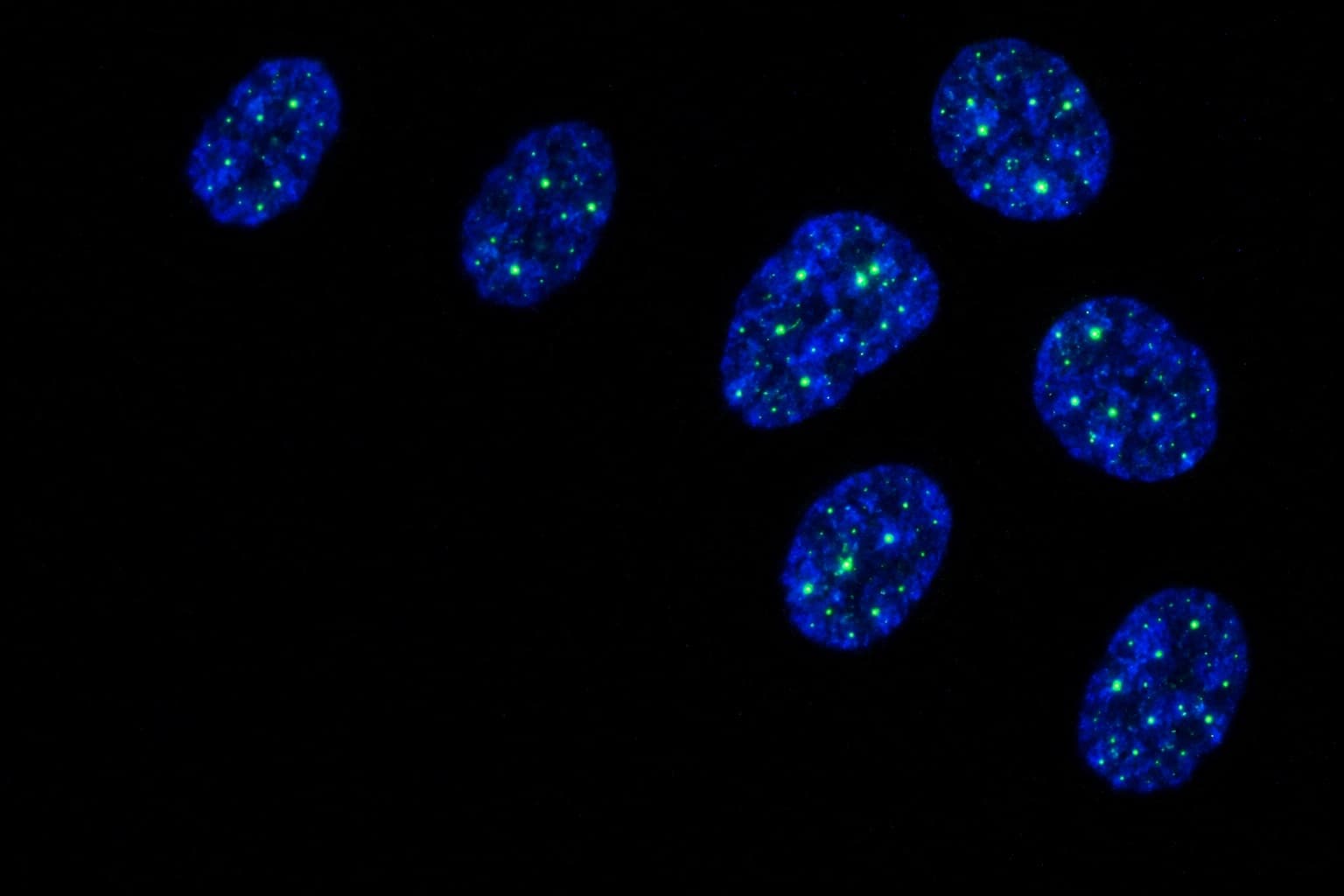 Fluorescence micrograph of cell nuclei with bright DNA-repair foci