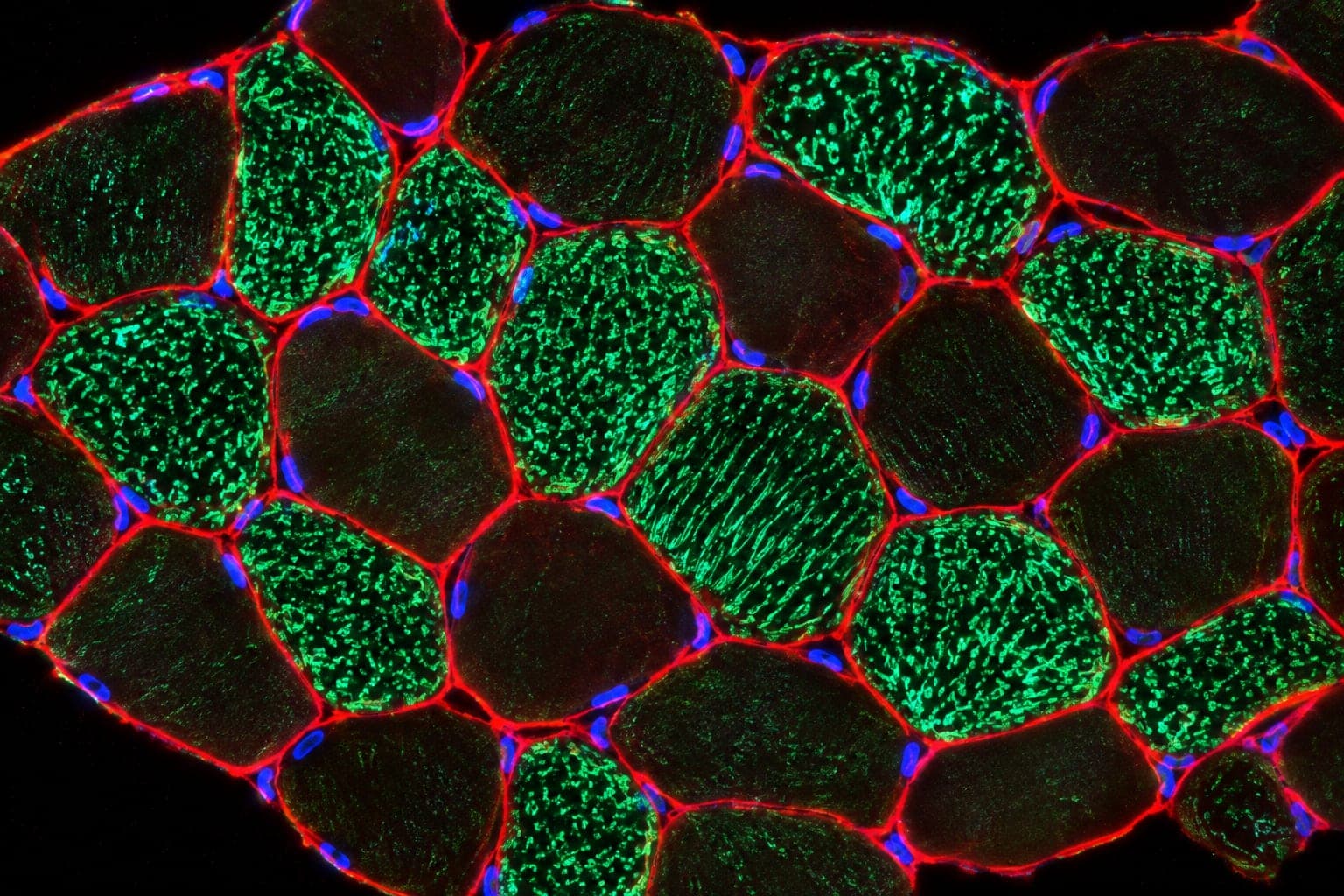Fluorescence micrograph of a muscle cross-section: slow-twitch fibres dense with mitochondria (green) beside paler fast-twitch fibres