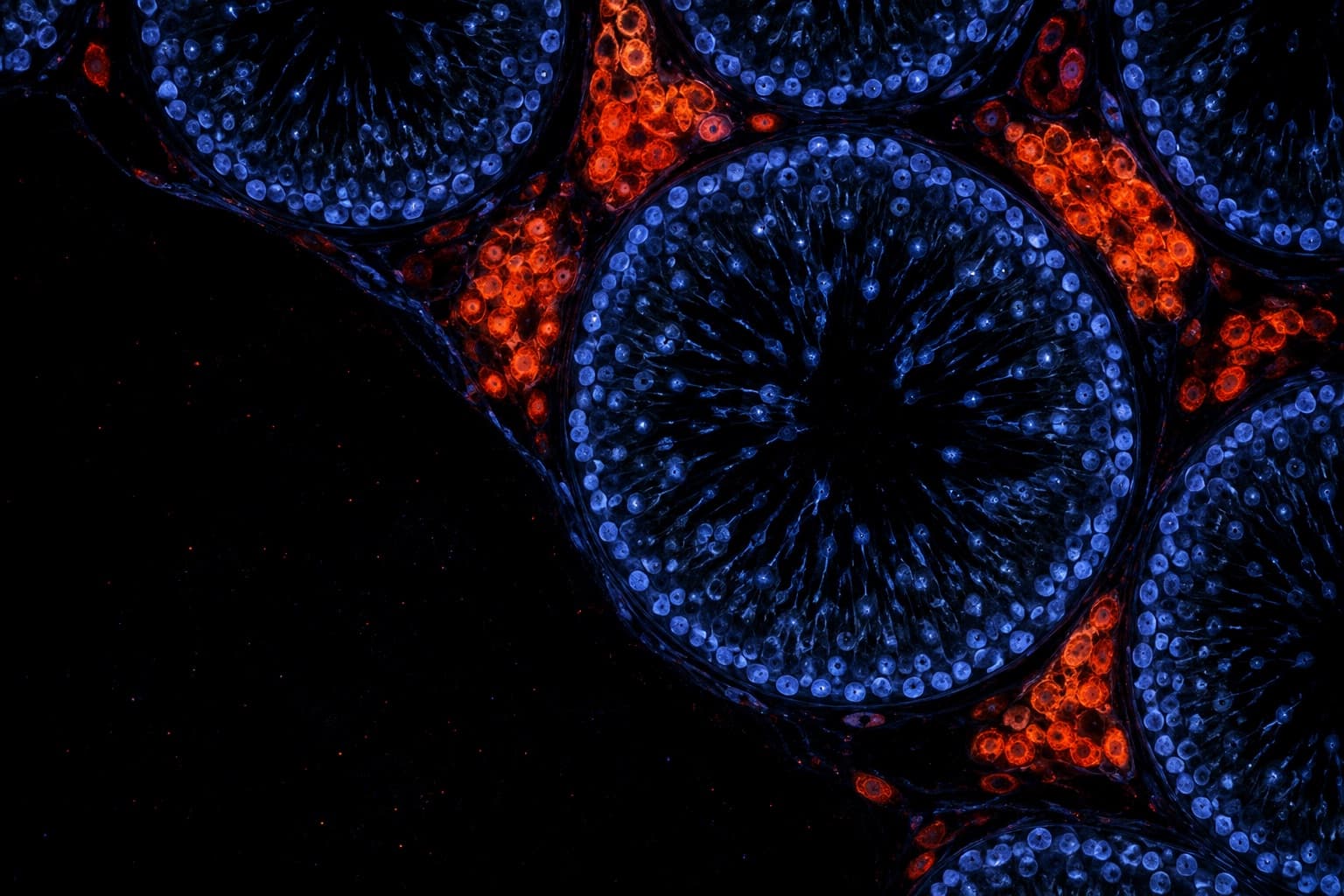 Fluorescence micrograph of testis tissue with testosterone-producing Leydig cells between the tubules