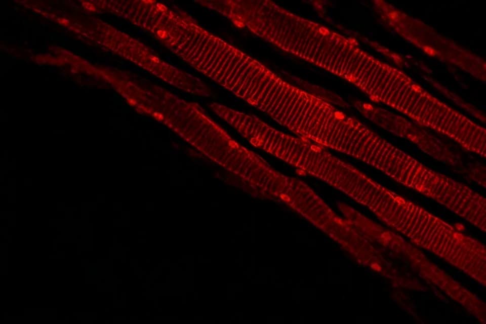 Skeletal muscle fibres, fluorescence micrograph